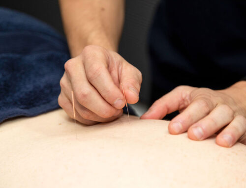 WHAT IS DRY NEEDLING AND HOW DOES IT HELP?