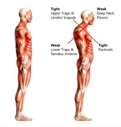 How Manual Osteopathy Can Fix A Bad Posture?