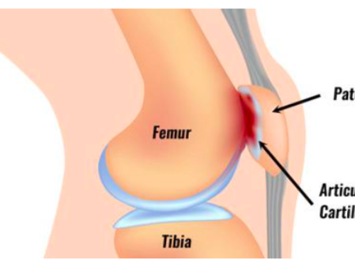 PAIN AT THE FRONT OF THE KNEE?